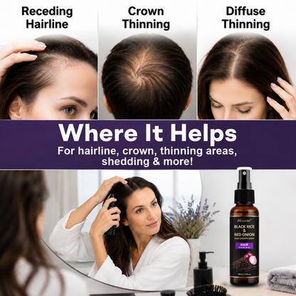 🔥Alcuras® Black Rice & Red Onion Hair Growth Spray