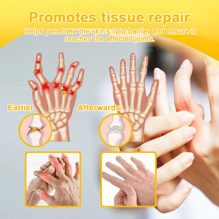 Alcuras® Bee Venom Pain-Relief Bone Healing Cream 🇺🇸(Specially for older adults)