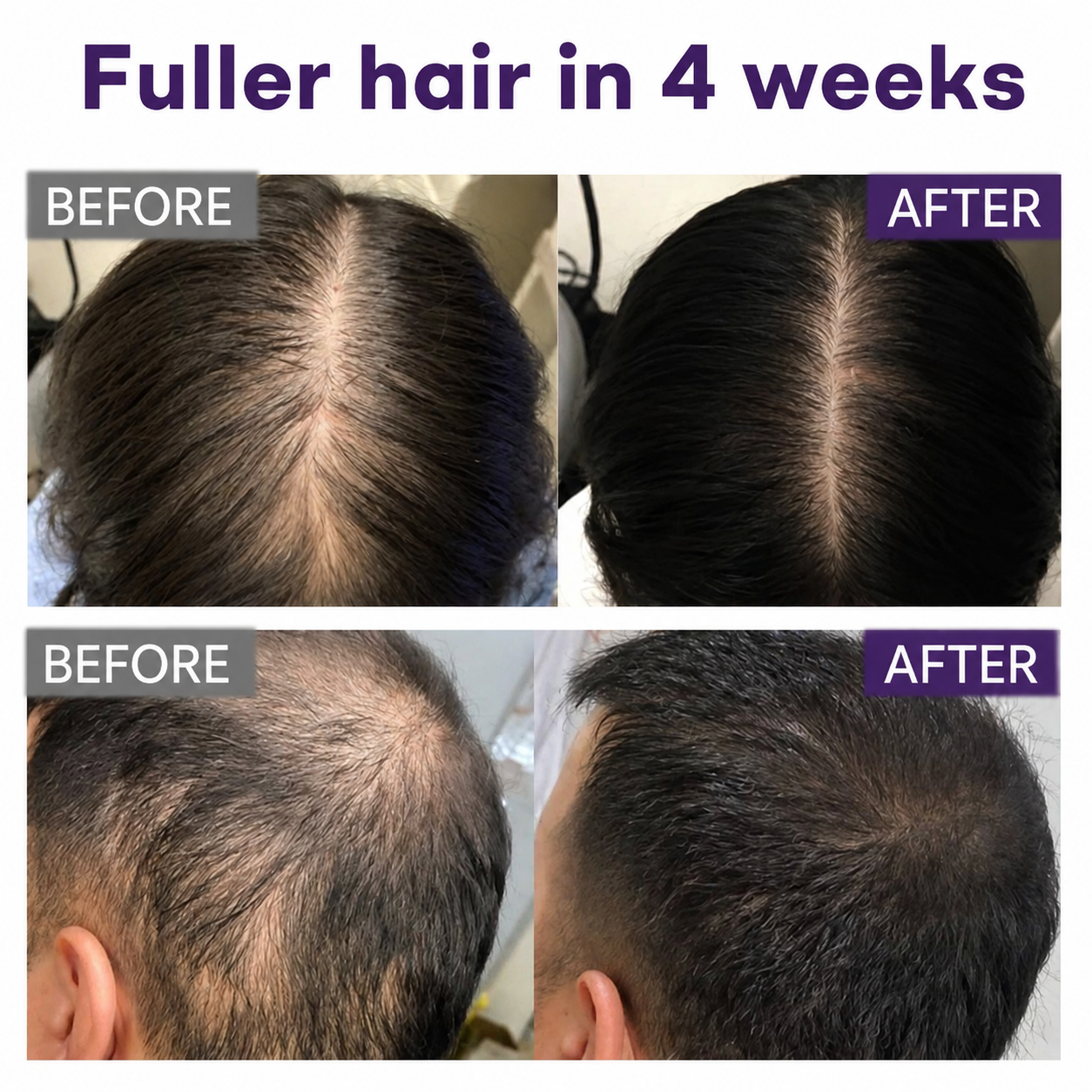 🔥Alcuras® Black Rice & Red Onion Hair Growth Spray
