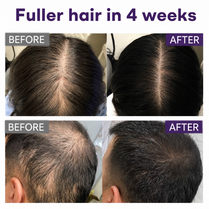 🔥Alcuras® Black Rice & Red Onion Hair Growth Spray