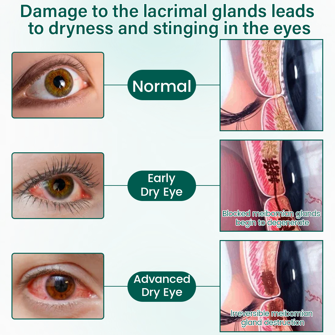 Alcuras®  OptiClear Nano Eye Roller Serum