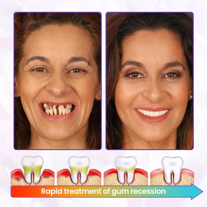 Alcuras® Advanced Gum Healing Toothpaste