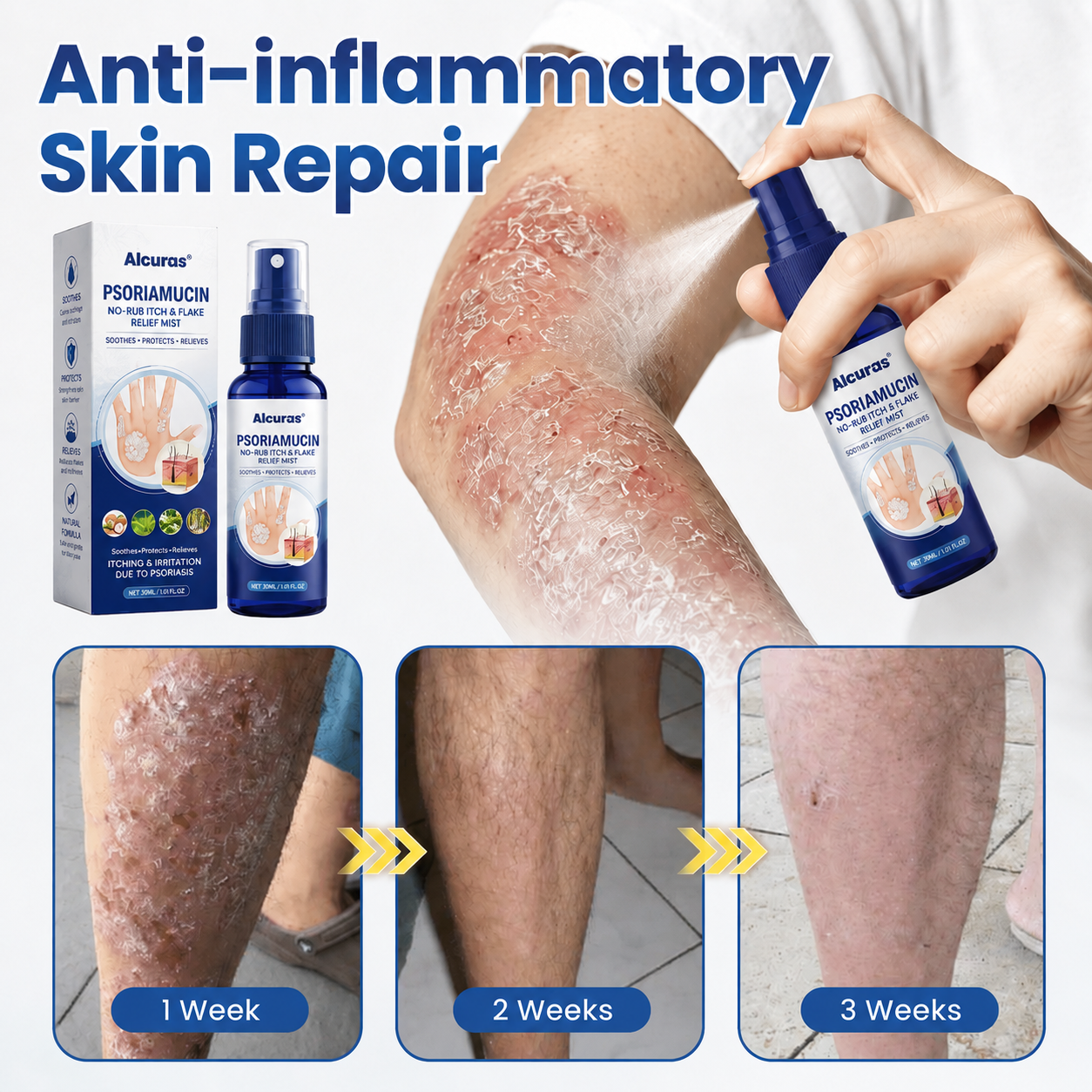 Alcuras®  PsoriaMucin No-Rub Itch & Flake Relief Mist