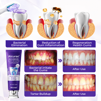 Alcuras® Advanced Gum Healing Toothpaste