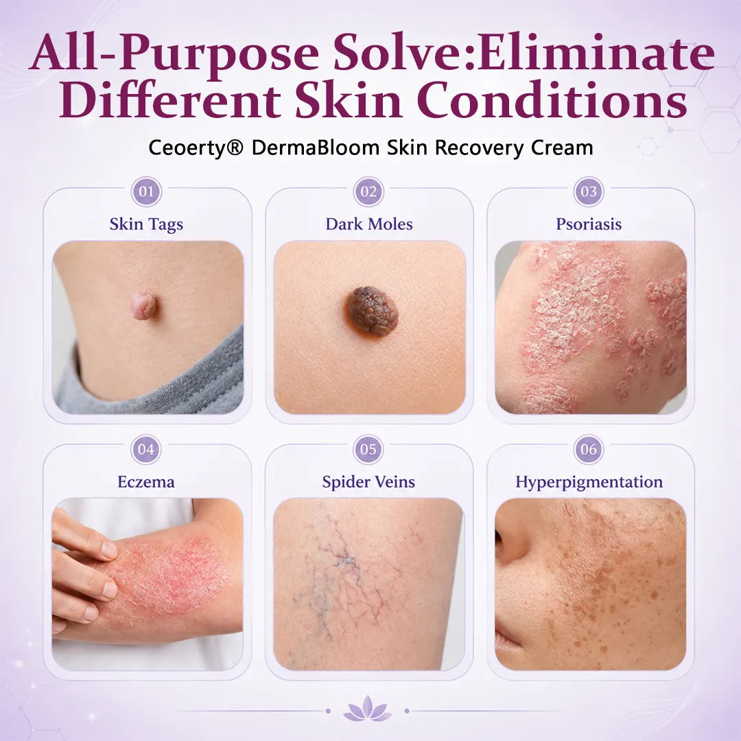 Alcuras® DermaBloom Skin Recovery Cream