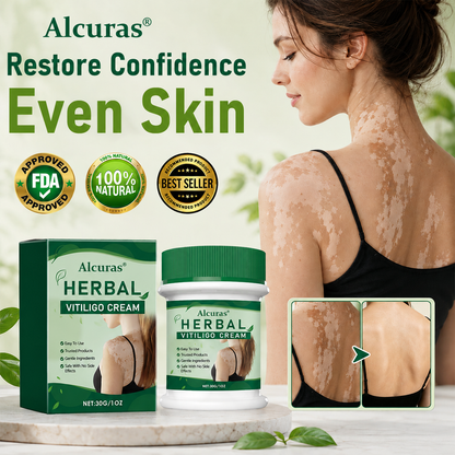 Alcuras® Herbal Vitiligo Cream