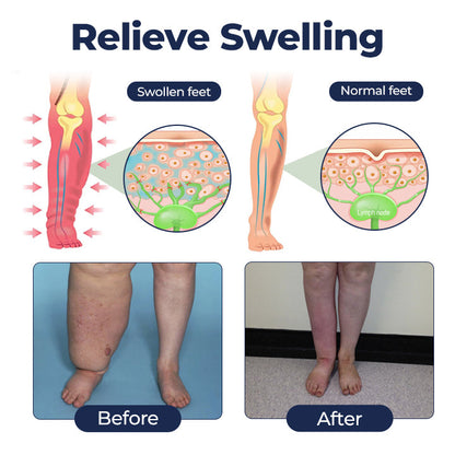 Alcuras® SwellRelief Circulation Support Cream🇺🇸